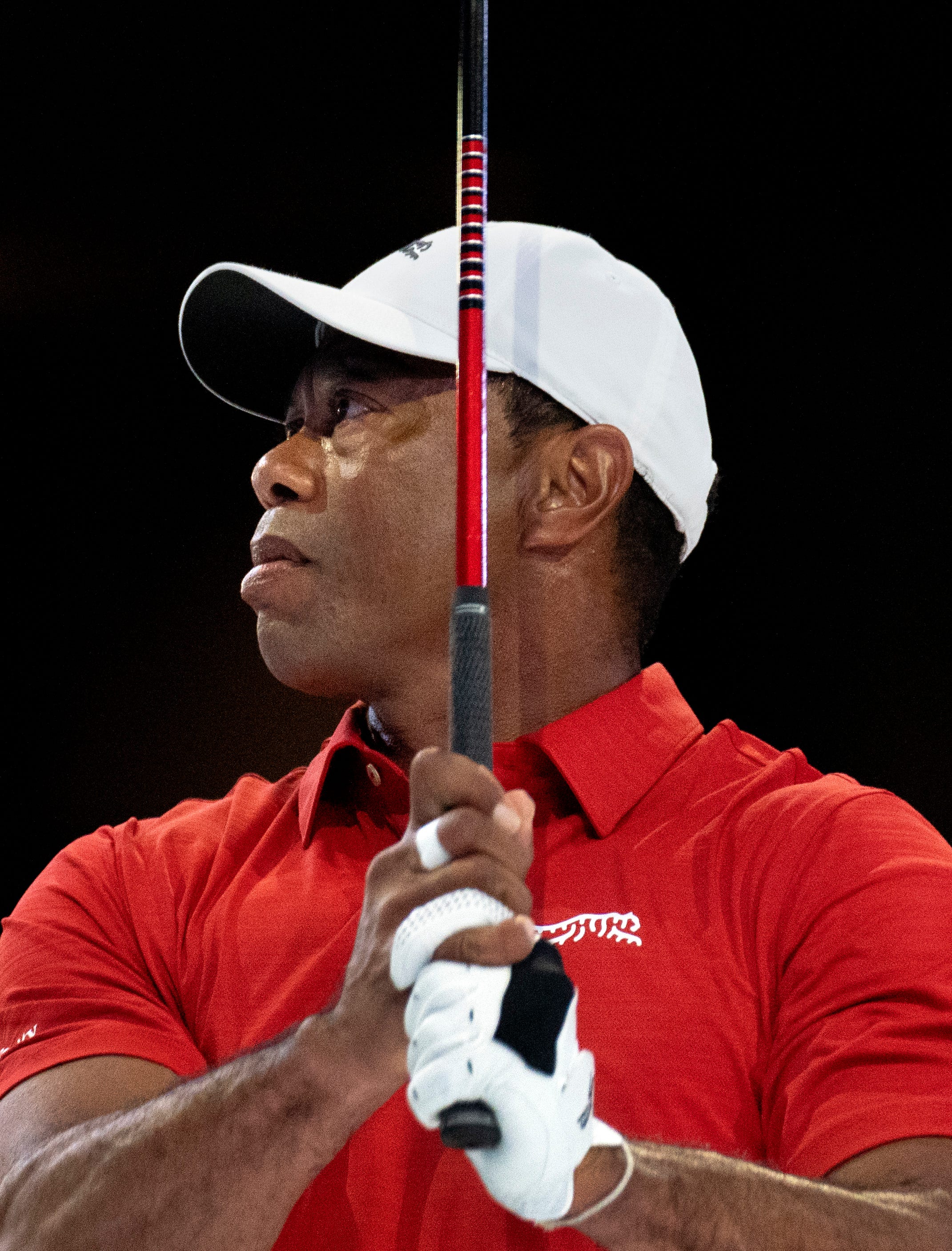 Will Tiger Woods play in the Masters? See his latest health update