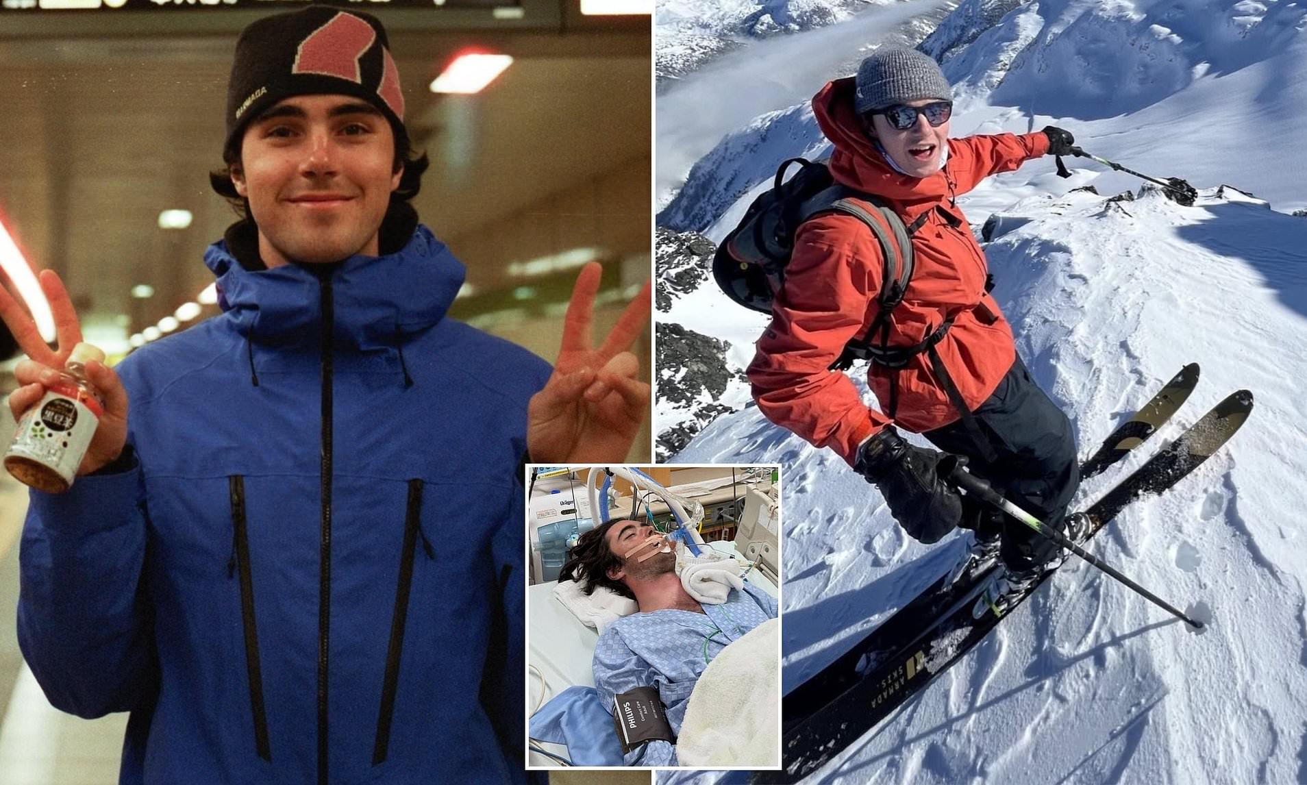 Tragedy as son of Olympic skier dies aged 23 after being buried in ...