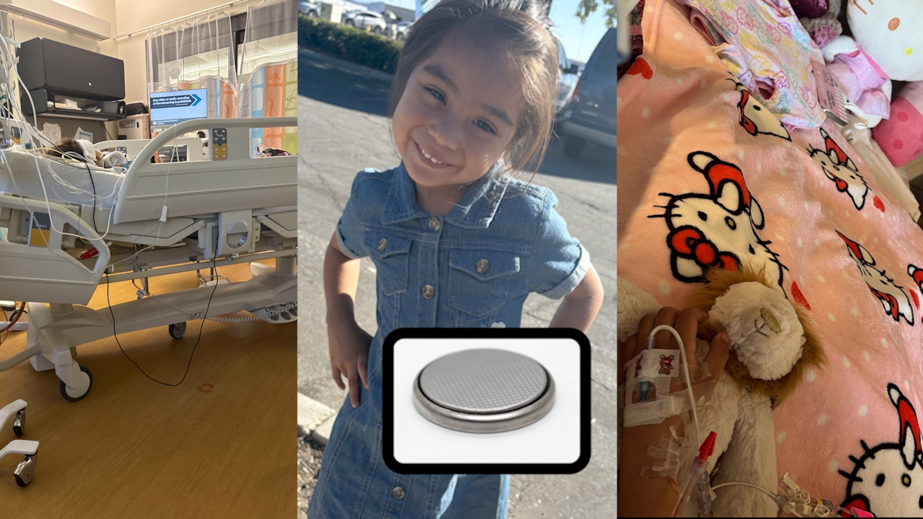 Photo inspiration: Fresh Look at 4 Year Old Girl Hospitalized After Swallowing Button Battery Family