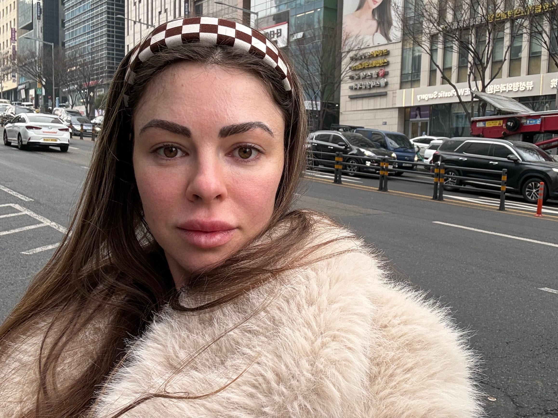 Ich bin 34 und für ein Mini-Facelift nach Seoul geflogen – darum finde ...