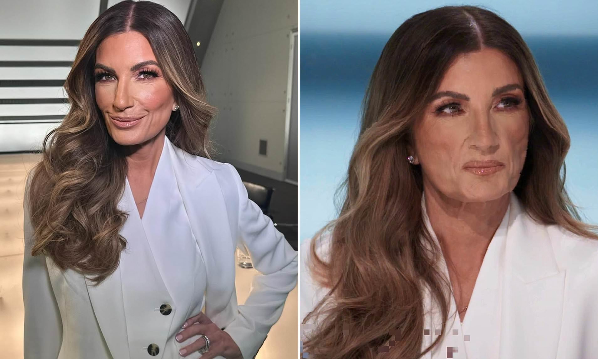 karren brady plastic surgery Image 5