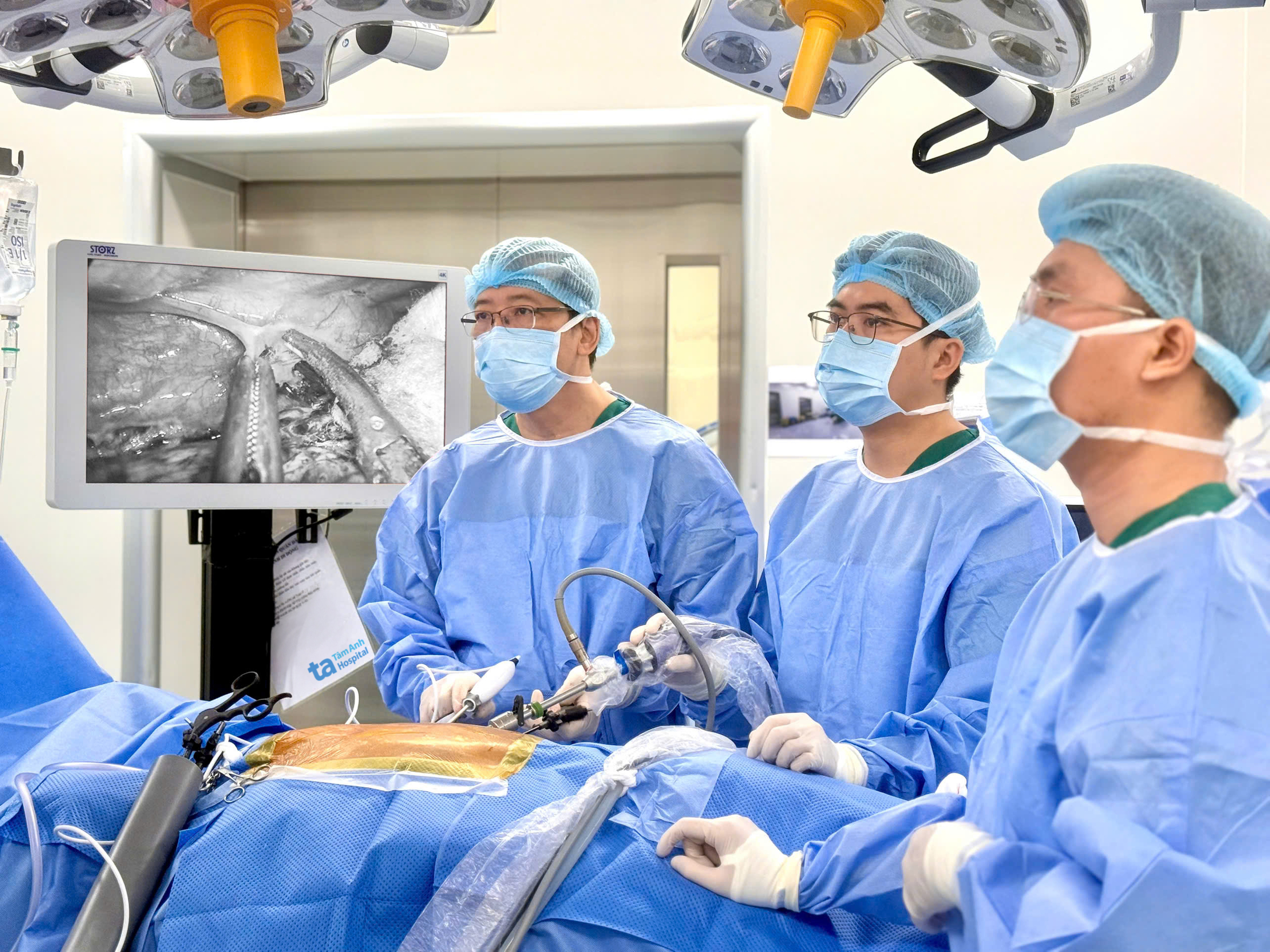 Ung thư thực quản di căn gây đau ngực