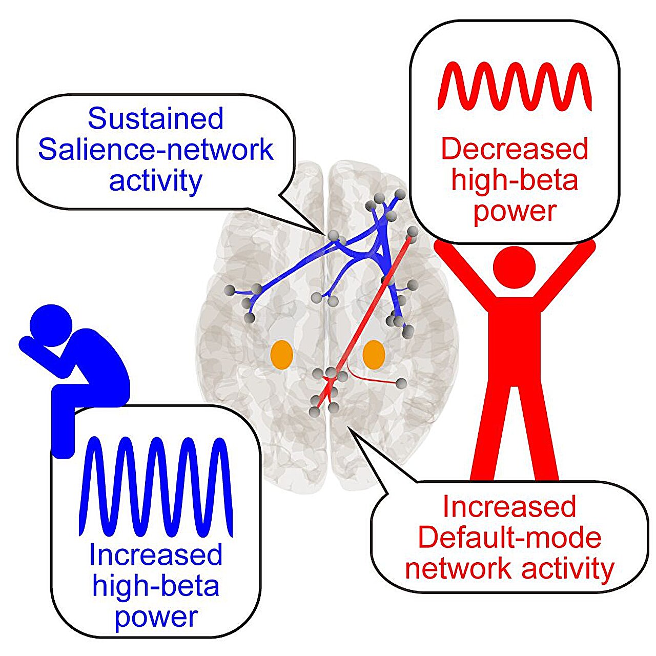 Hidden 'resilience window' found in human brain one hour after stress