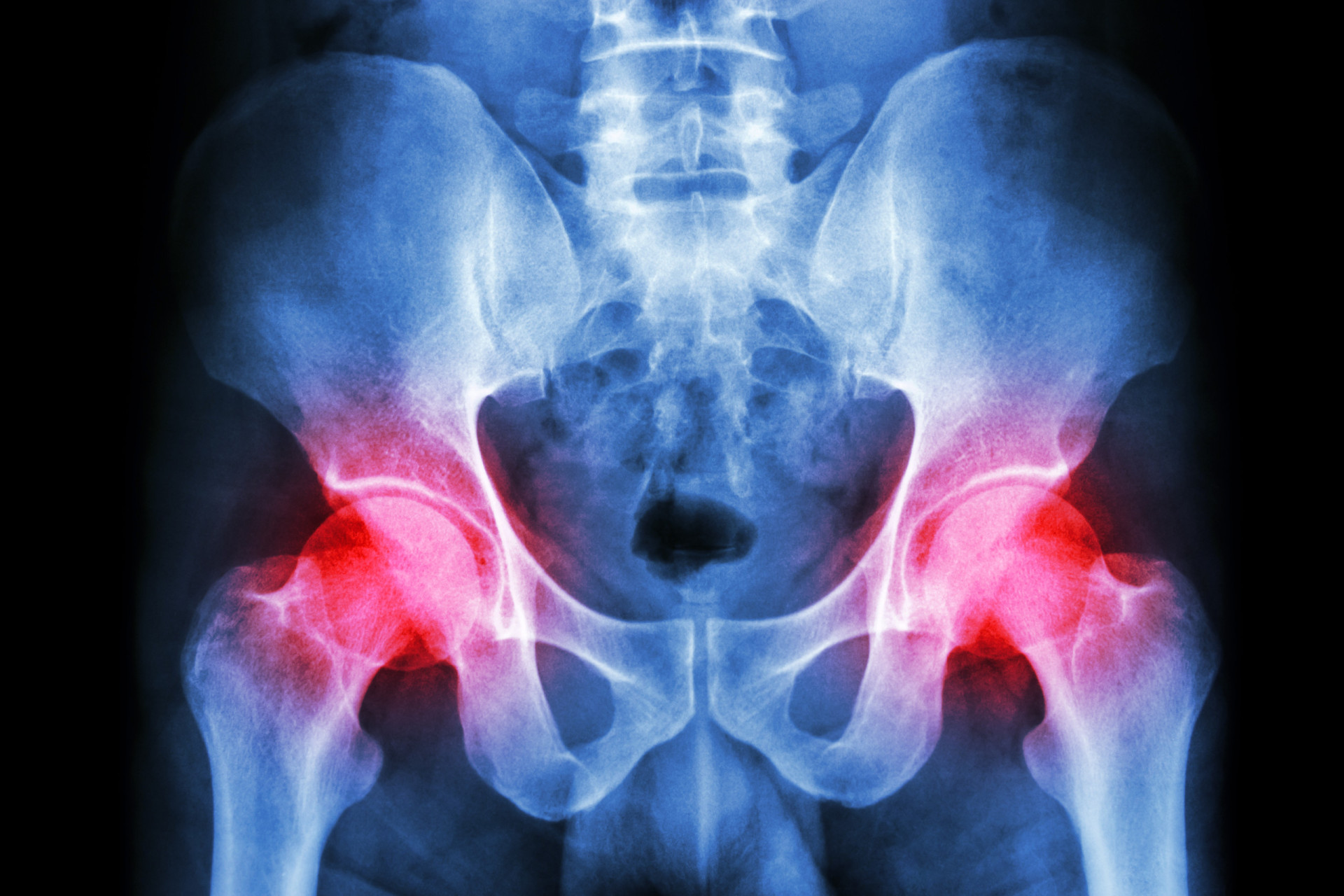 the-painful-and-debilitating-condition-that-is-arthritis