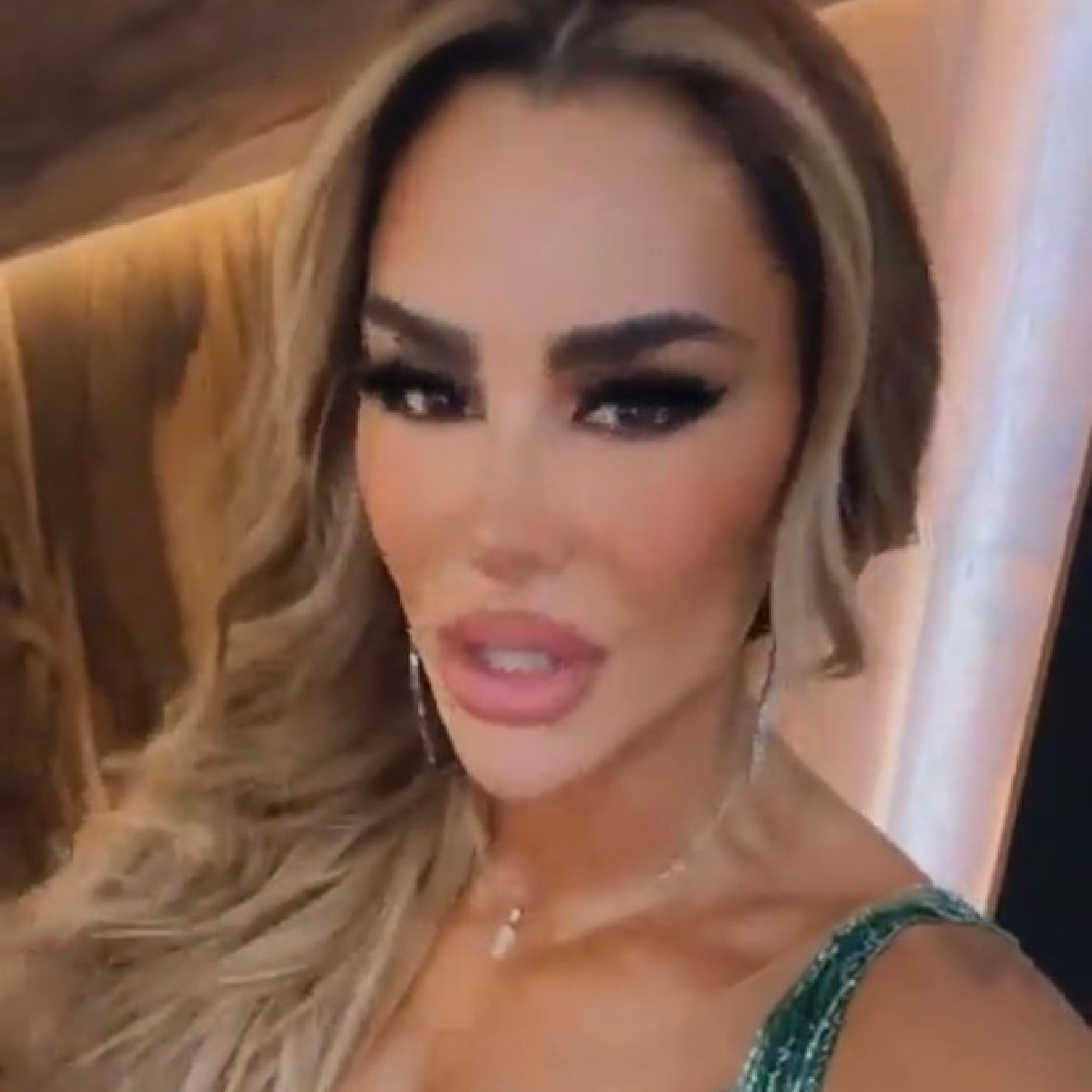 ¿Qué Le Pasó A Ninel Conde? El Antes Y El Ahora De La Estrella En Fotos