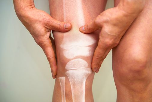 ¿qué hacer cuando la rodilla está inflamada?