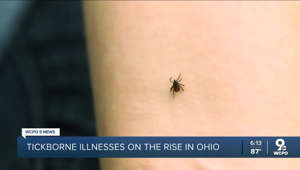 Tickborne illnesses on the rise in Ohio
