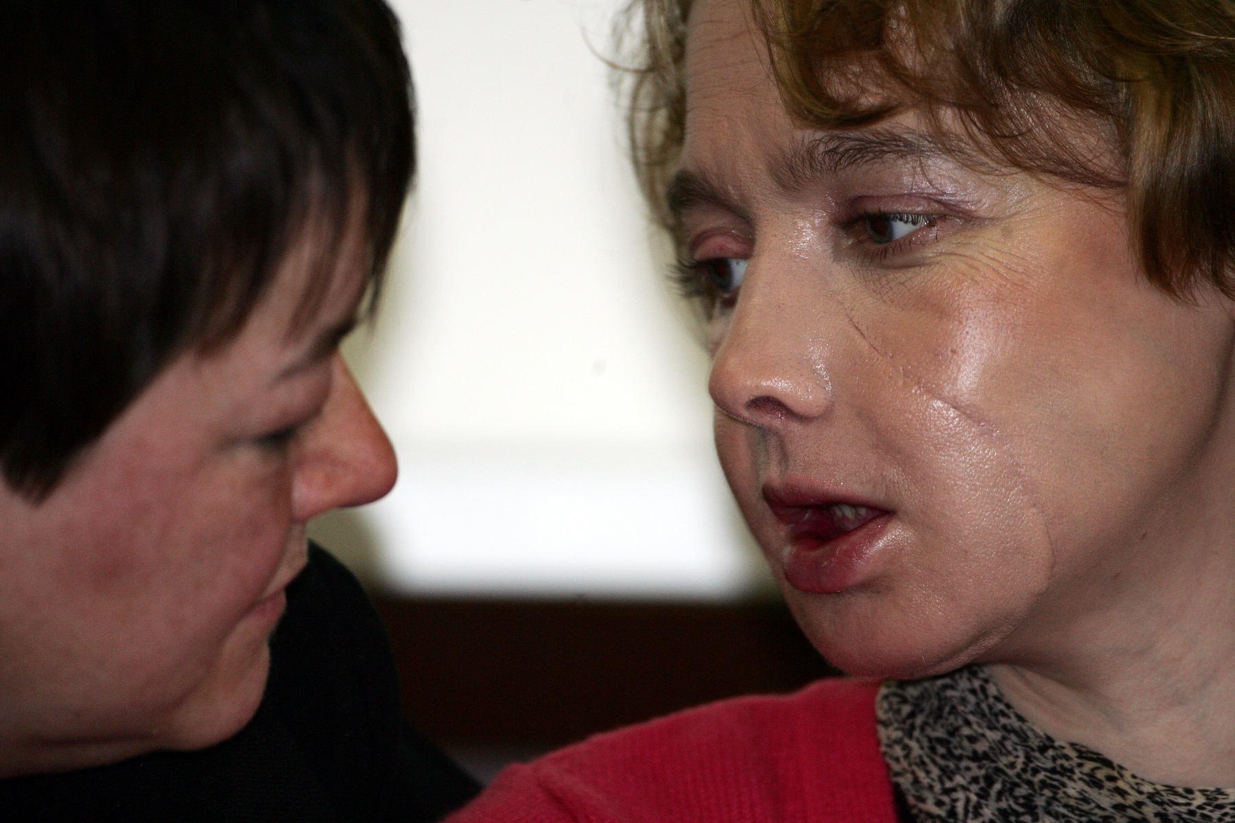 20 facts about organ donation around the world