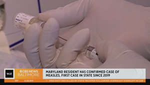 Maryland resident has confirmed case of measles, first case in the state since 2019