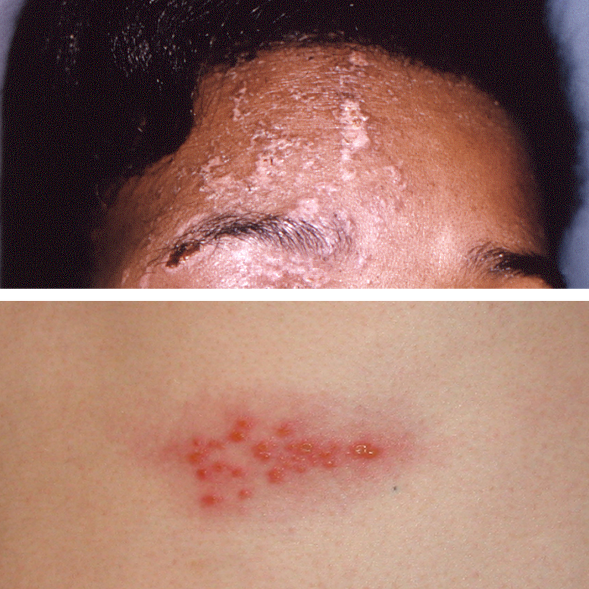 These Pictures Will Help You Identify the Most Common Skin Rashes