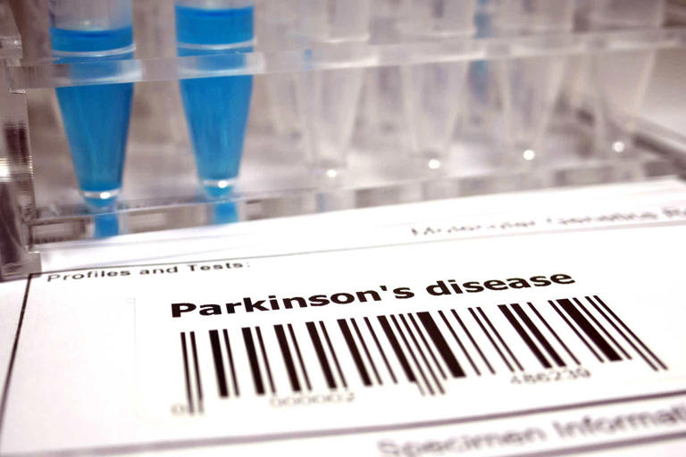 Annovis Bio to post late-stage data for Parkinson's drug in June