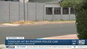 Toddler hit by Phoenix police car