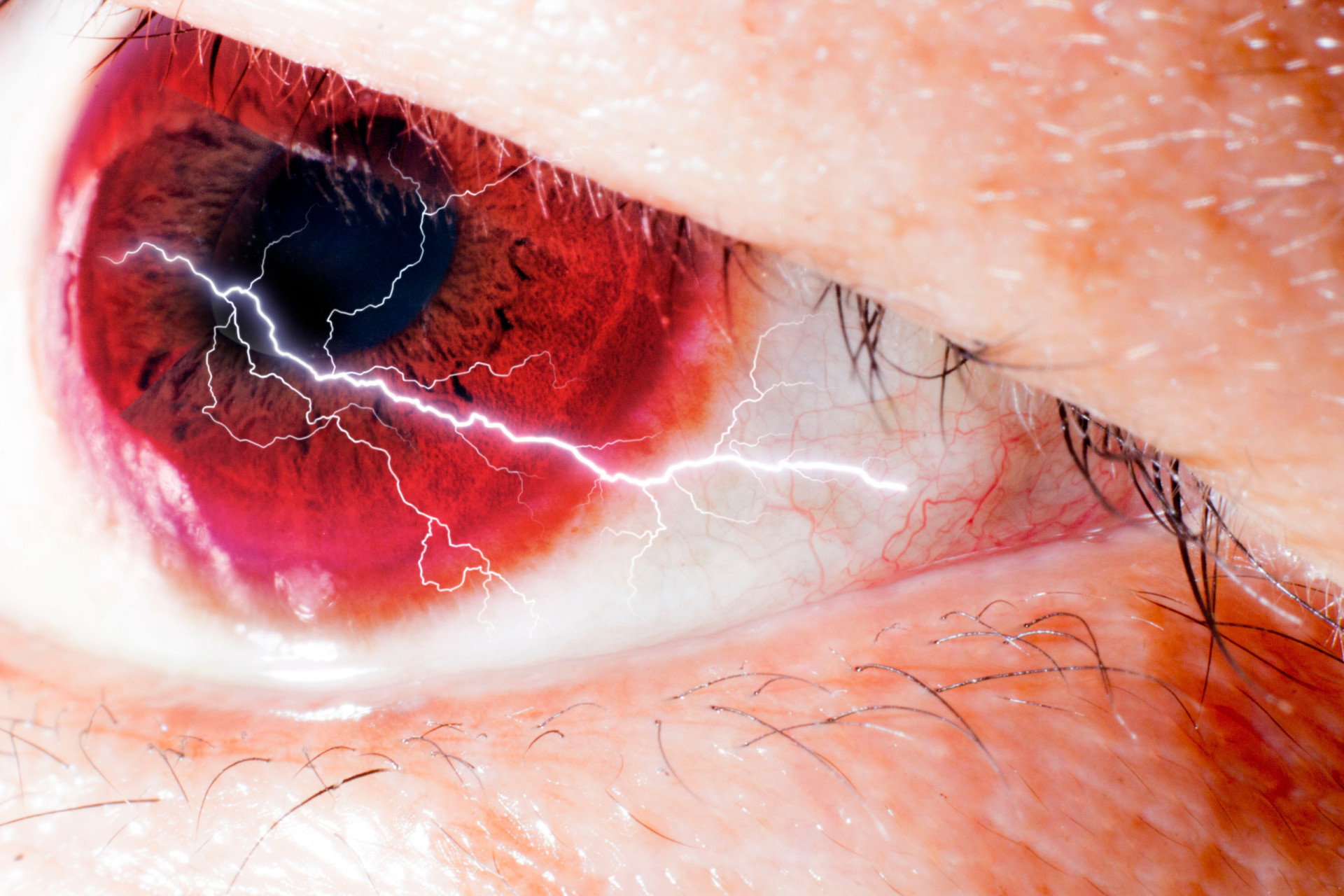 Life is a blur: Everything you need to know about cataracts