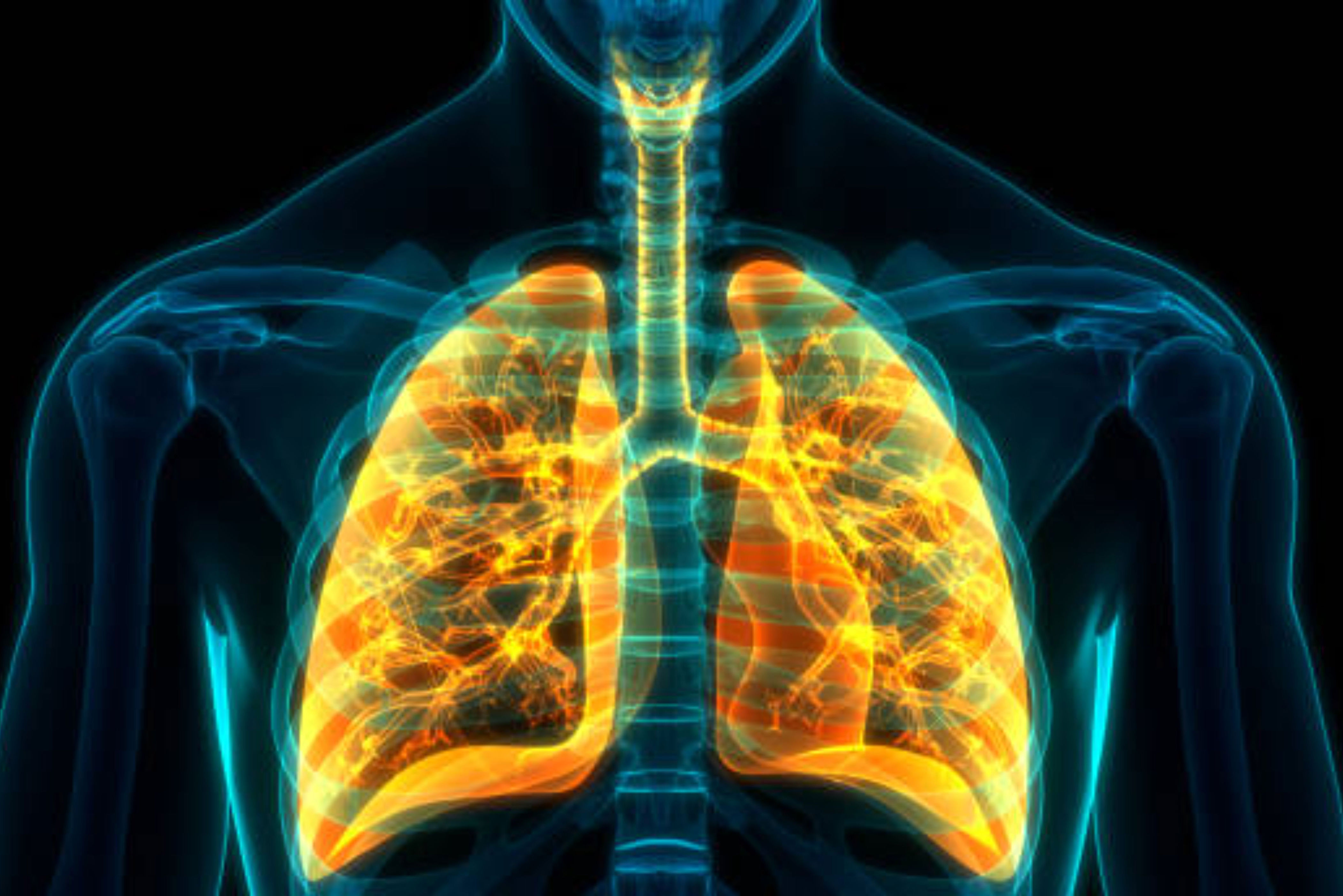 Лечение поражения легких. Хроническая обструктивная болезнь лёгких. Хроническая обструктивная болезнь лёгких (ХОБЛ). Заболевания органов дыхания ХОБЛ.