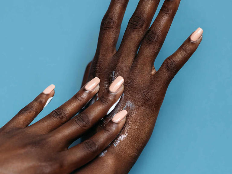 Why the Skin On Your Hands Is Peeling—and How to Stop It