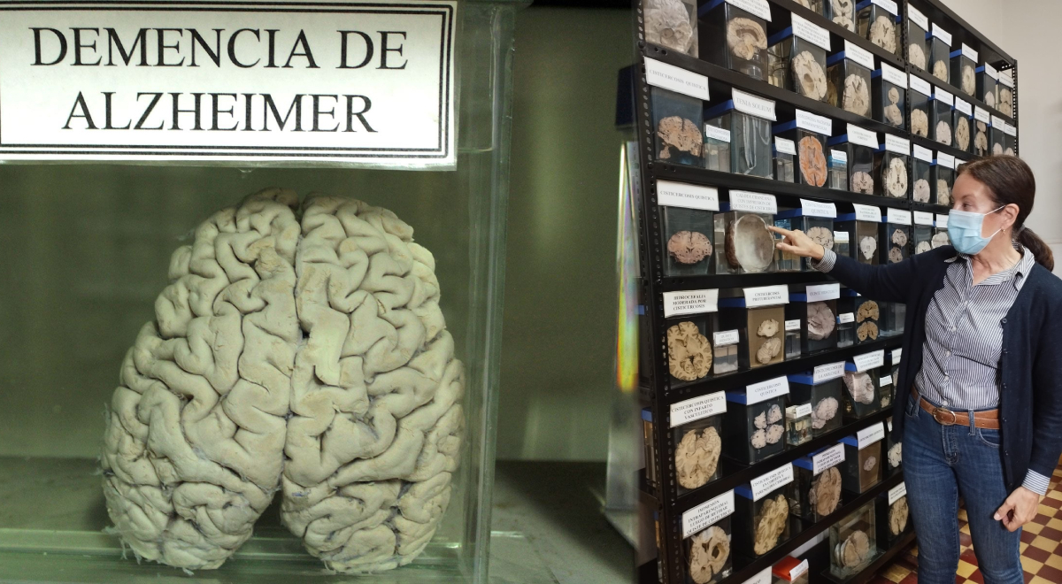 Conoce El Museo De Cerebros Humanos En Barrios Altos ¿cómo Llegar Y Cuánto Está La Entrada 9820