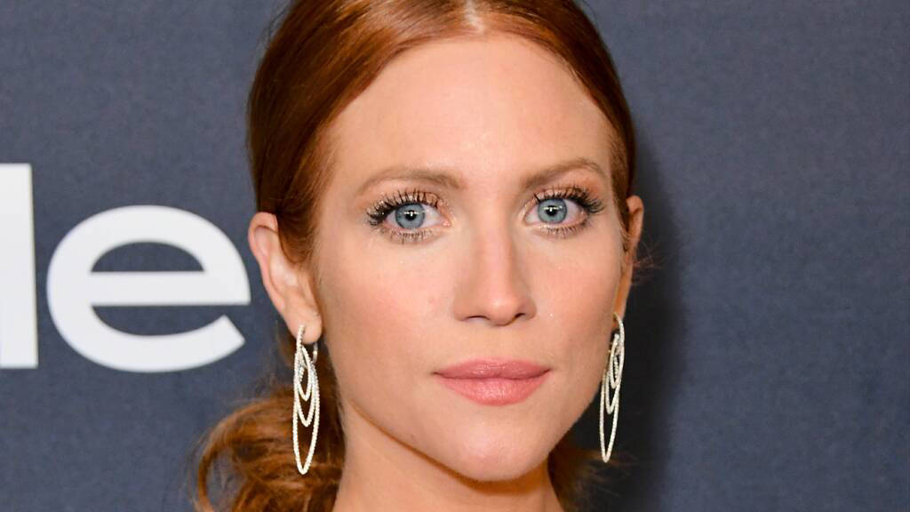brittany snow scar on forehead