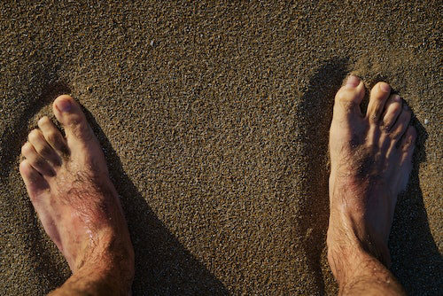 Why Do I Have Such Hairy Toes? A Podiatrist Explains