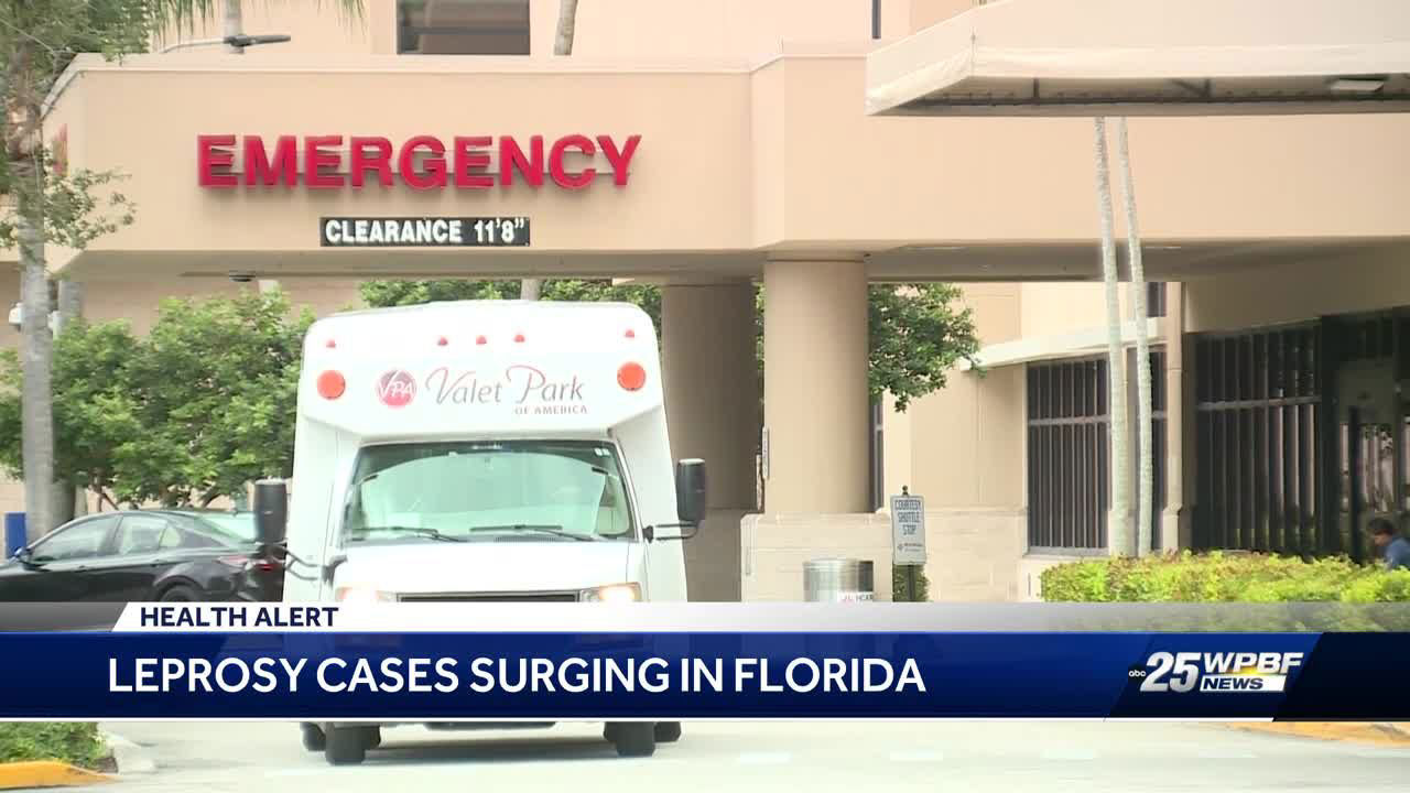 Leprosy cases surging in Florida