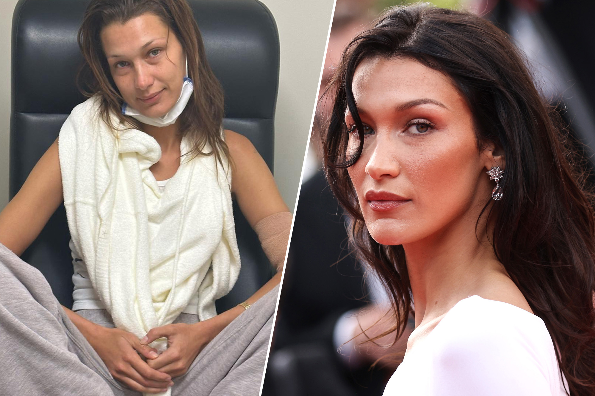 Bella Hadid Details ‘100 Days Of Lyme Disease Treatment And ‘almost 15 Years Of Invisible