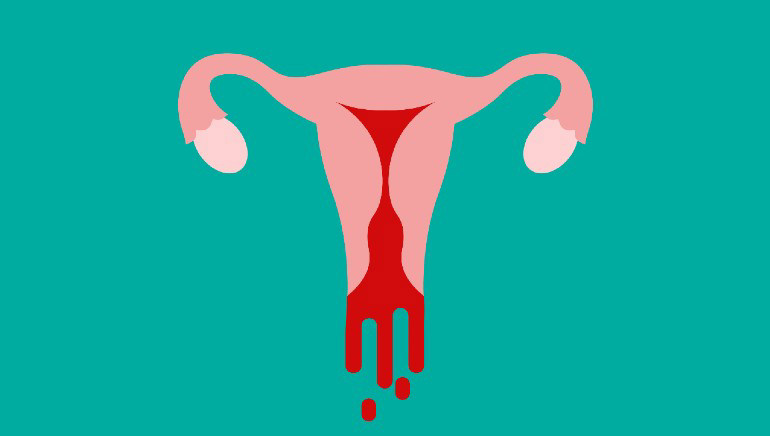 Vaginal Bleeding After Sex 4 Likely Reasons Why It Happens