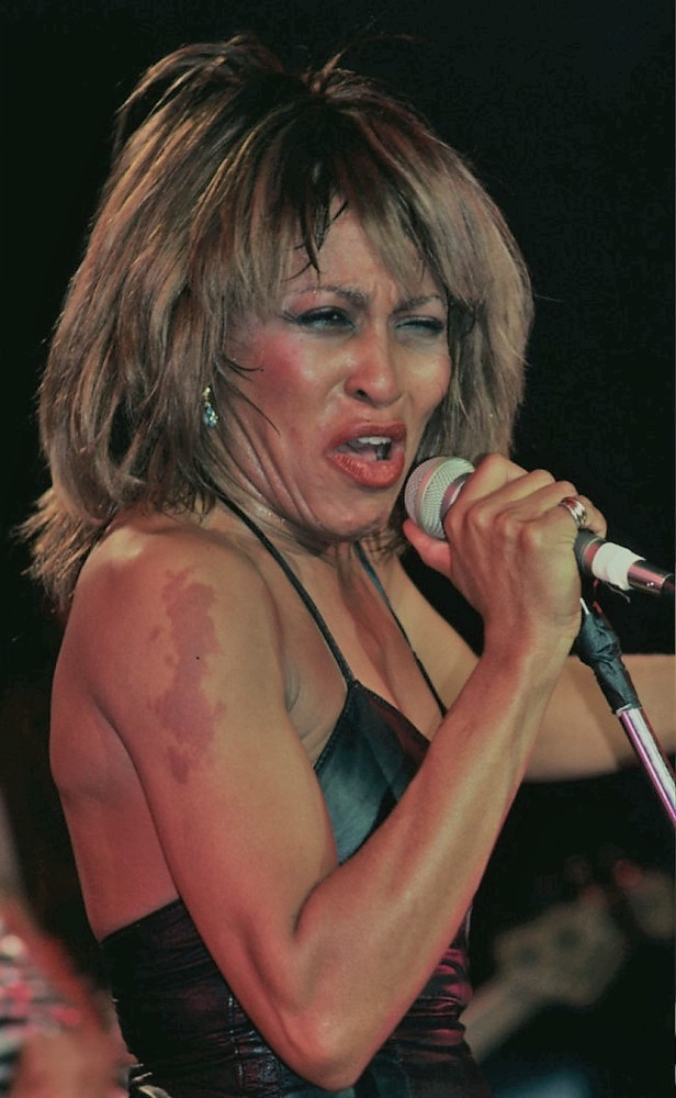 Birthmarks and the celebrities who embrace theirs