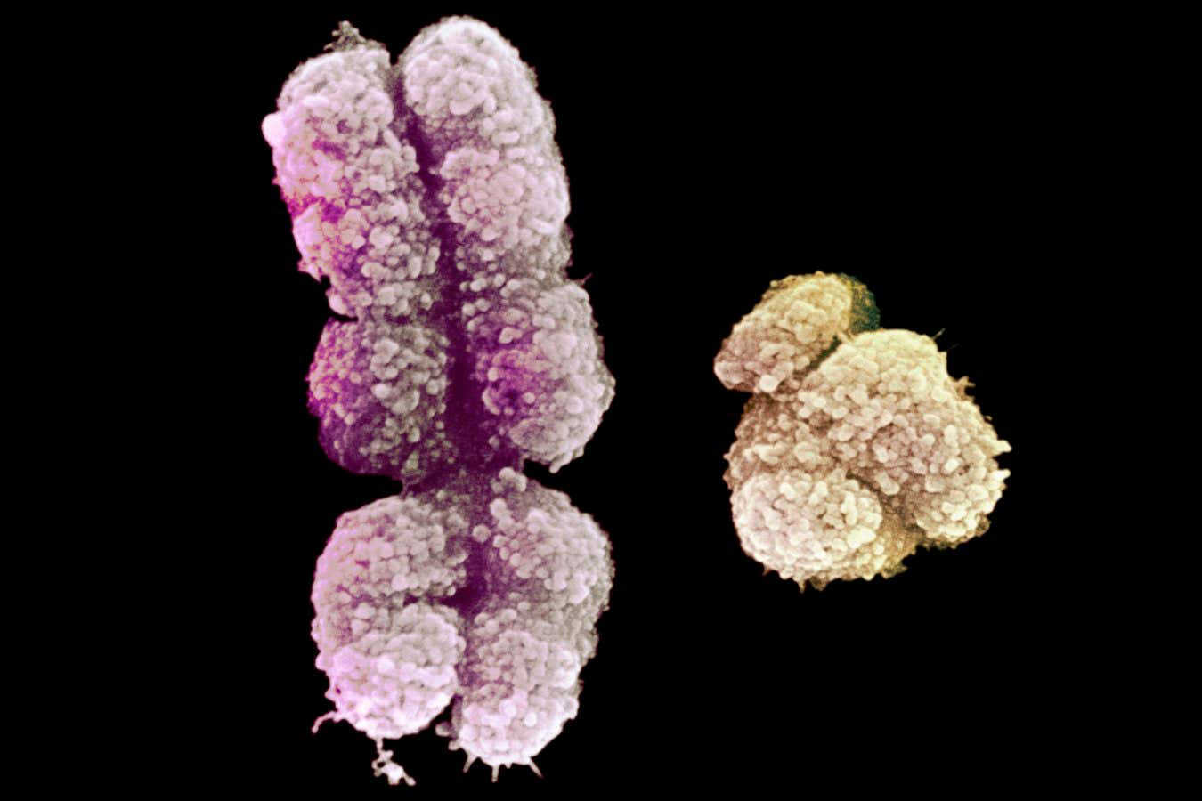 The Human Y Chromosome Has Been Fully Sequenced For The First Time