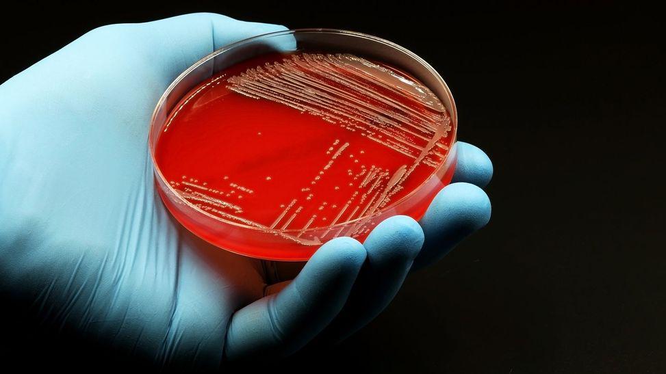 antibiyotikler bağırsaktaki faydalı bakterileri yok ediyor mu?