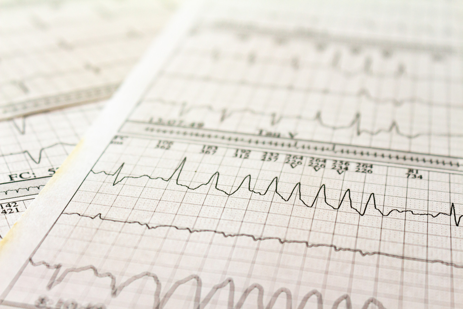 the-rare-inflammatory-condition-that-is-sarcoidosis