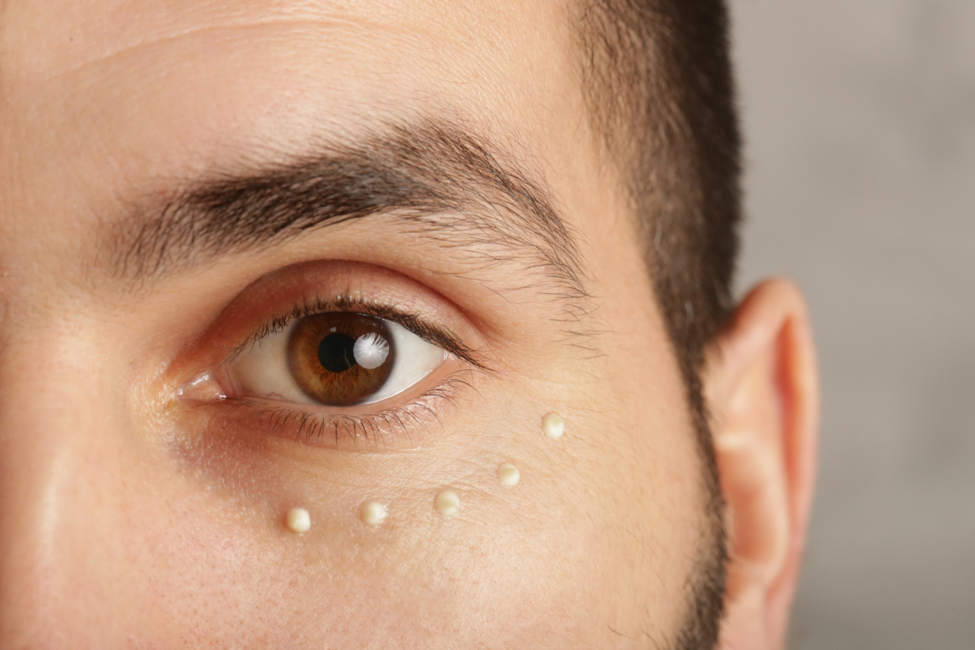 Ways to improve the look of your undereyes