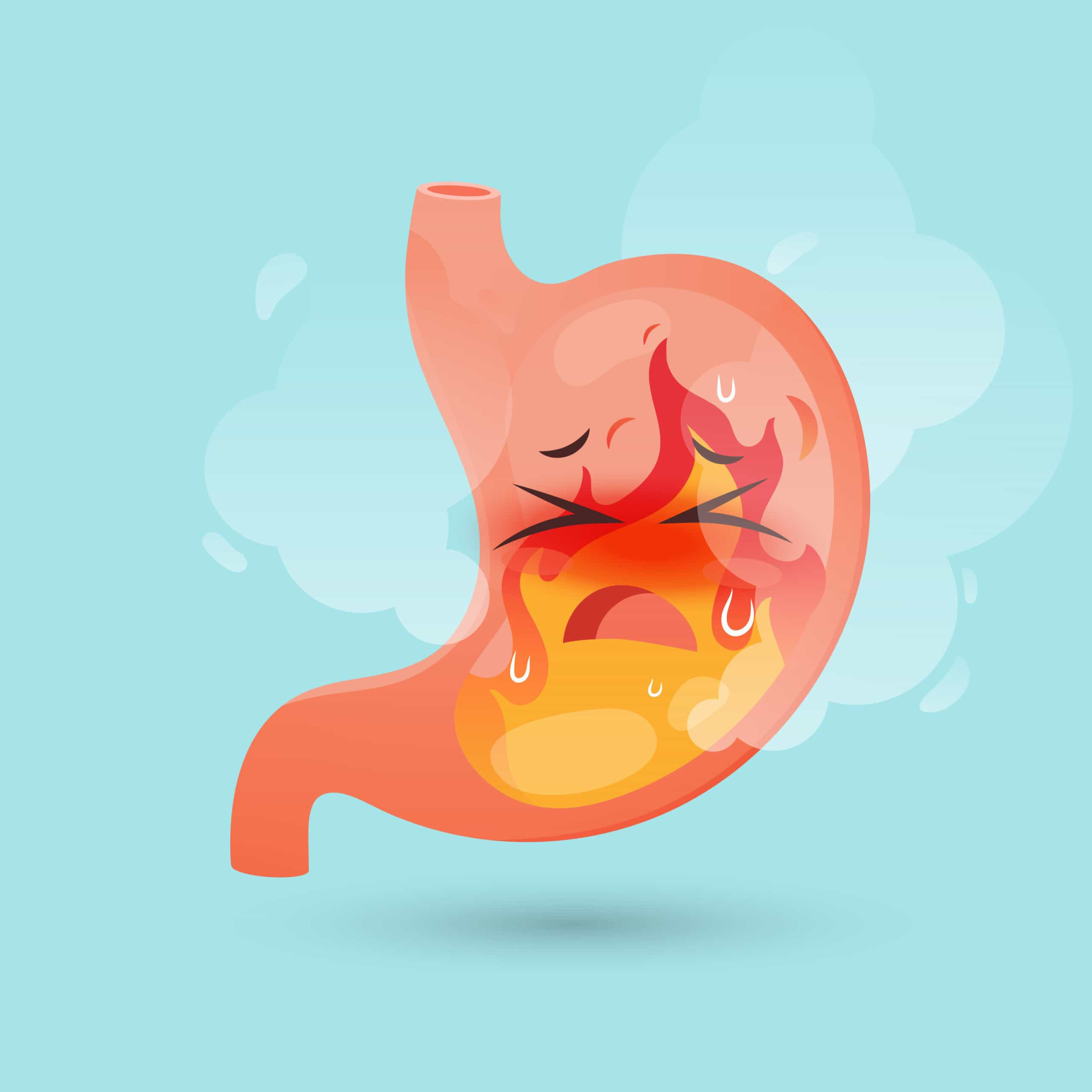 Do you know the warning signs of stomach cancer?