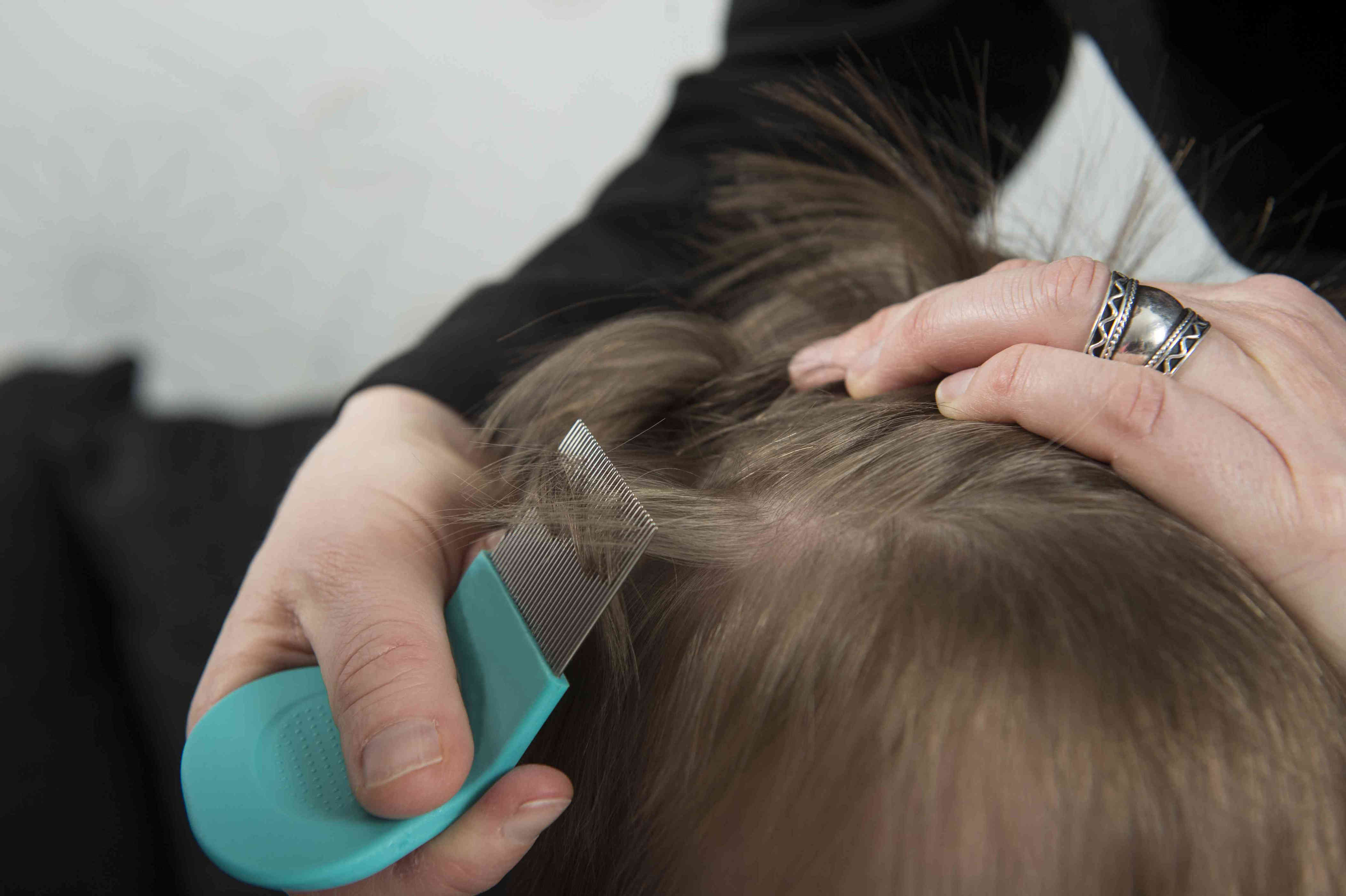 How Is Lice Treated?