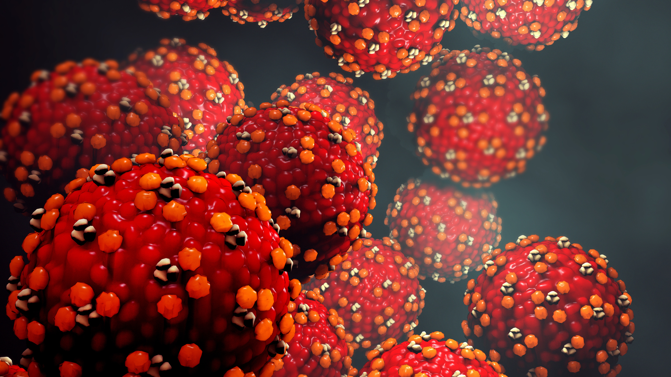 new measles case confirmed in sydney