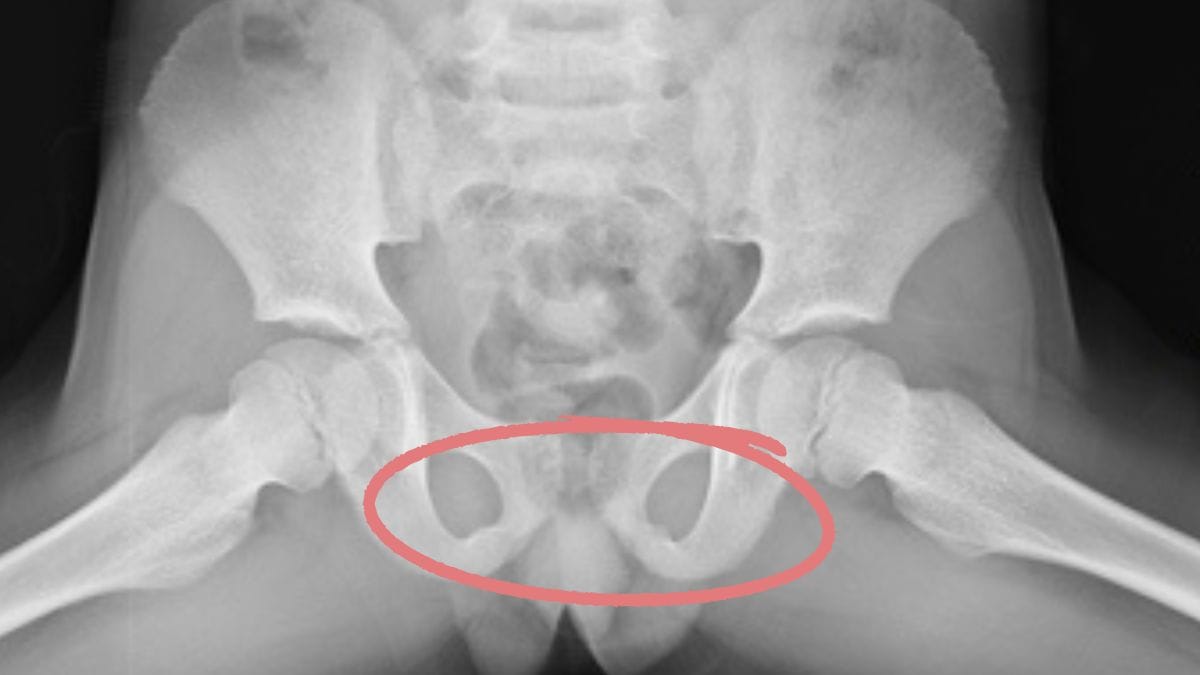 frau lässt sich röntgen: in ihrem becken erscheint plötzlich ein gesicht