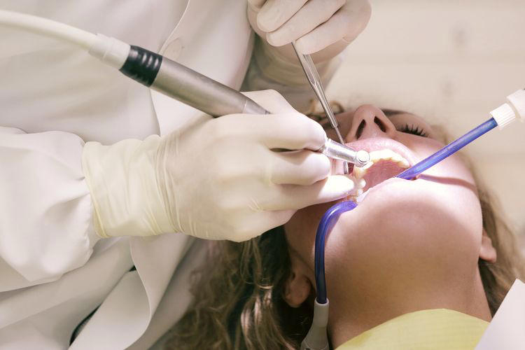 8 perawatan gigi yang ditanggung bpjs kesehatan 2024, termasuk scaling