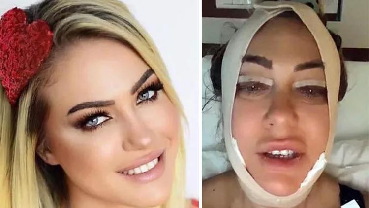 Seda Sayanın ablası estetik operasyonu geçirdi... Son hali şaşırttı!