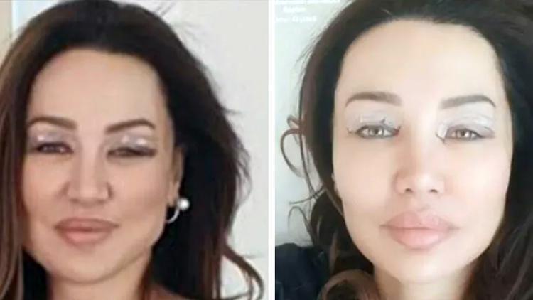 Seda Sayanın ablası estetik operasyonu geçirdi... Son hali şaşırttı!
