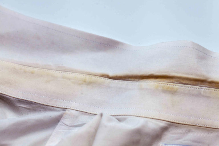 How To Get Yellow Stains Out Of Fabric