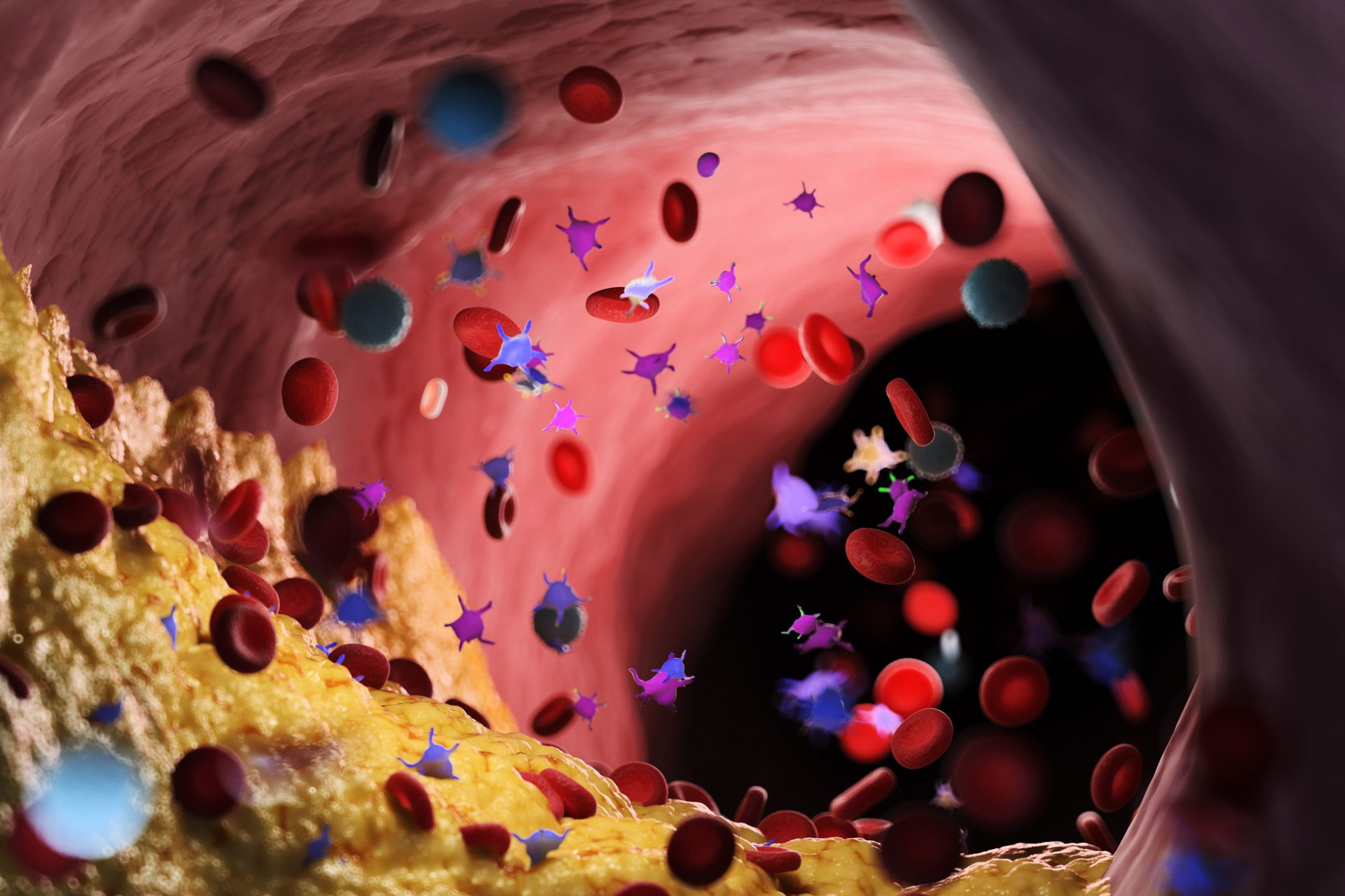 Just five modifiable factors are the leading causes of cardiovascular