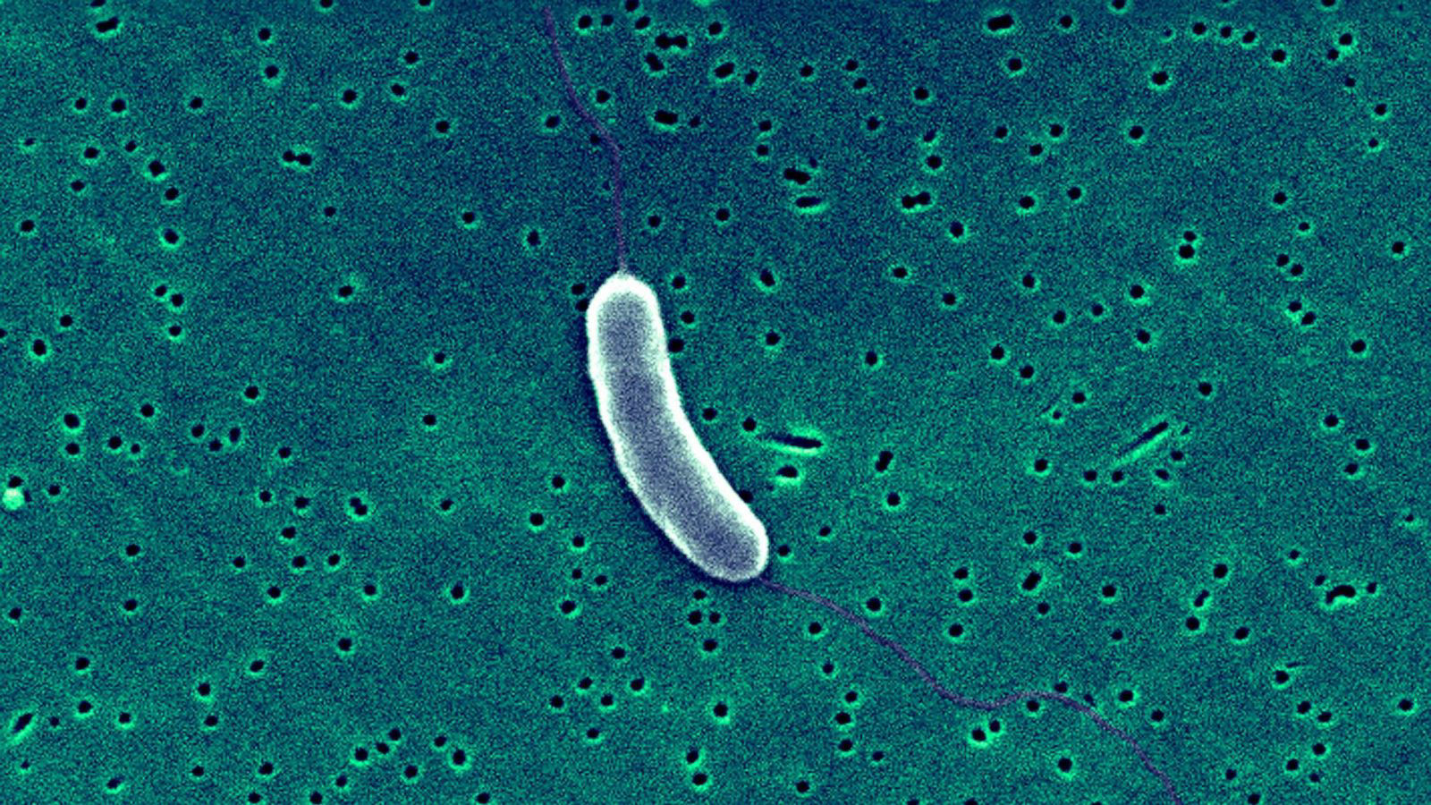 6 die from 'flesheating' bacteria in 3 East Coast states. Here's what