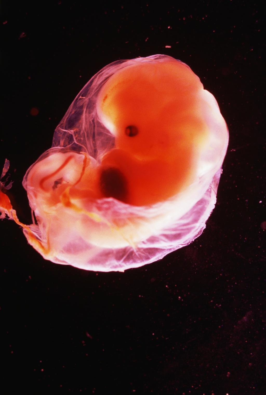 8 недель и 6 дней. Эмбрион 5-6 недели беременности. Зародыш на 6 неделе беременности.