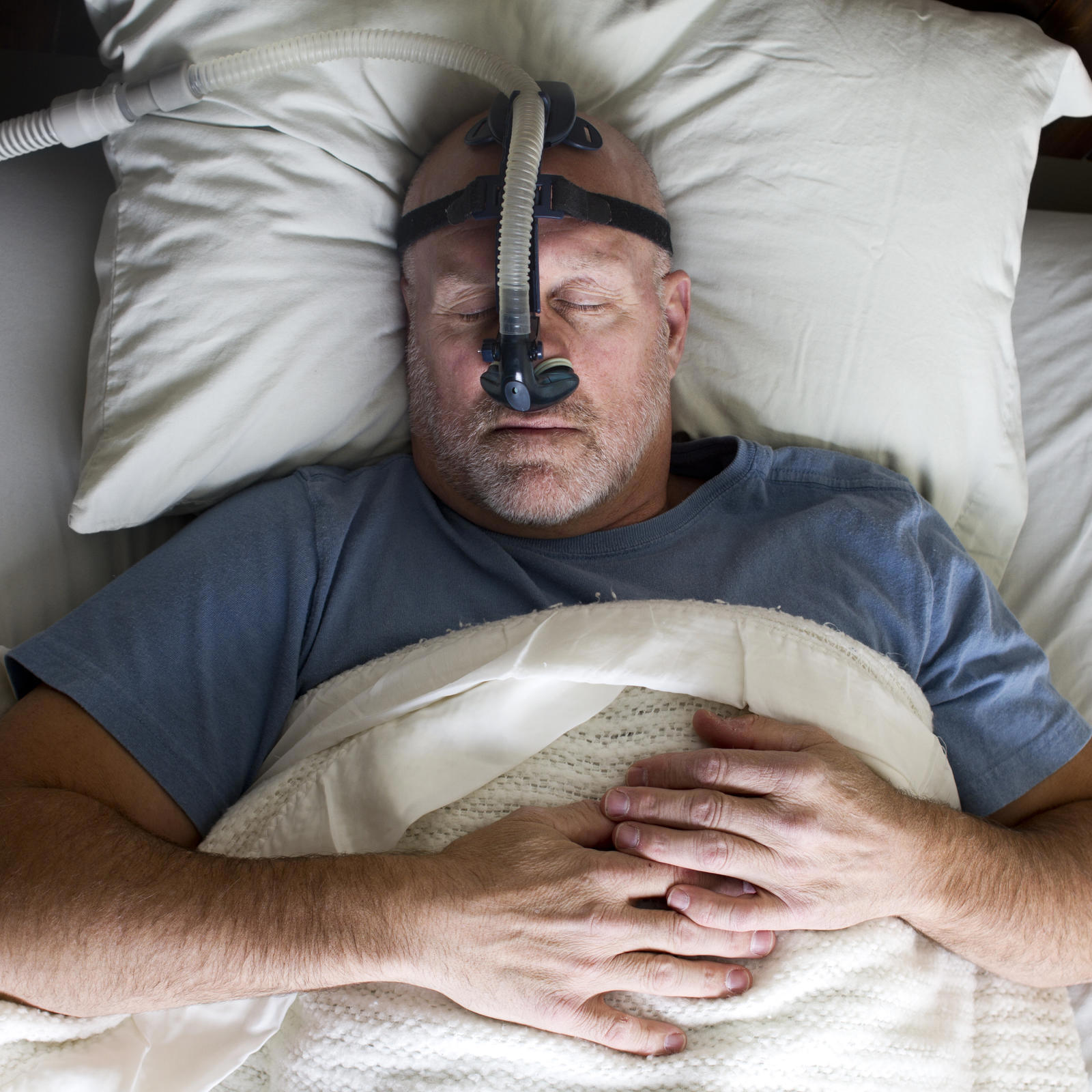 Philips Respironics Agrees To 479 Million Cpap Settlement 3696