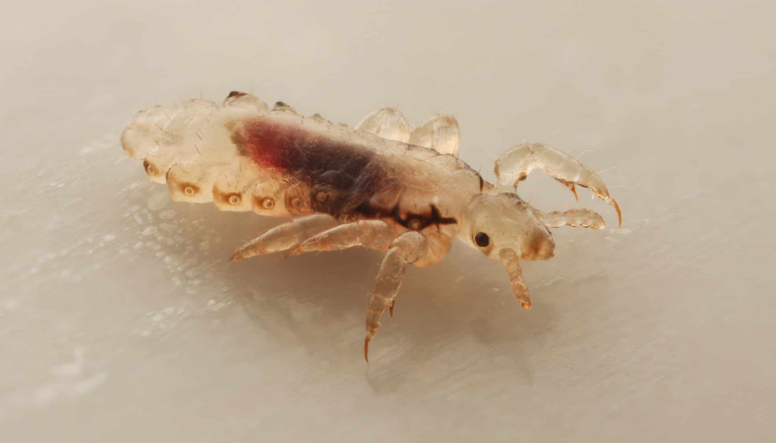 5 Smells That Lice Absolutely Hate