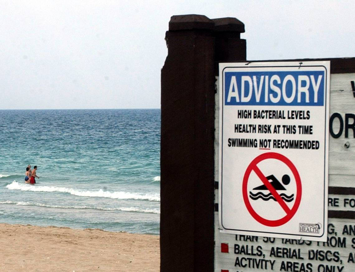 Swim Advisories Issued After Excessive Fecal Matter Found At These Miami Dade Beaches
