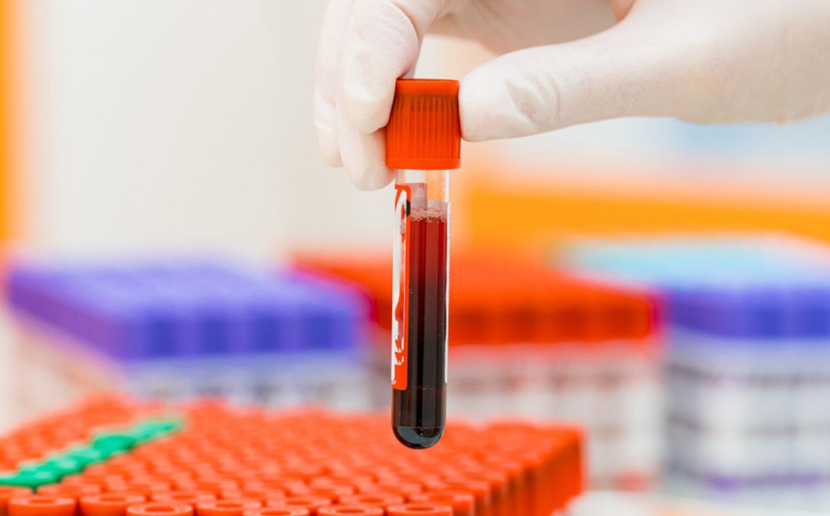por qué las pruebas de sangre no son confiables para detectar enfermedades