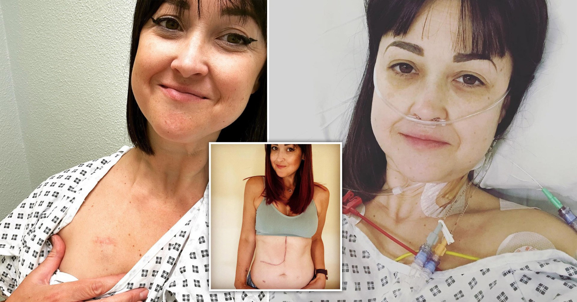 'I thought it was a stomach bug then doctors said I'd die before 40'