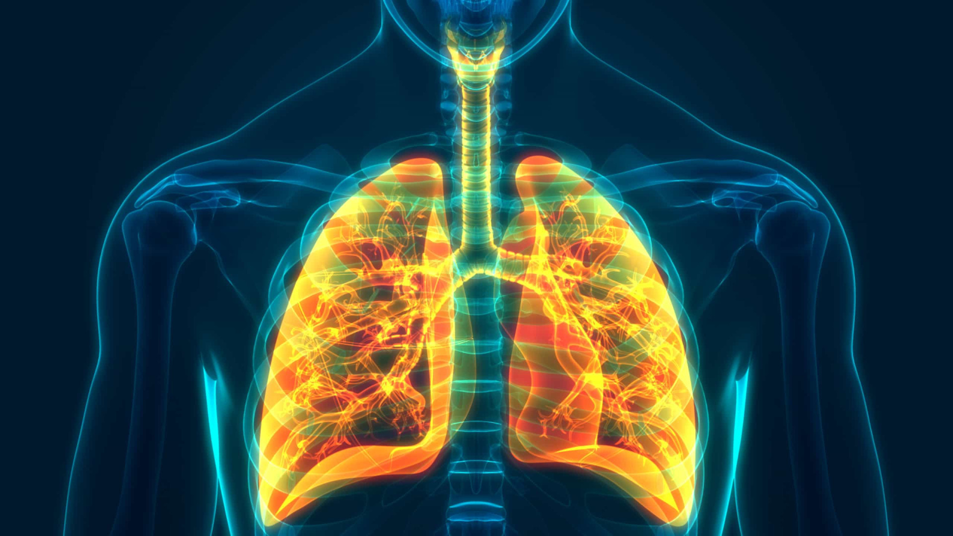 What is chronic obstructive pulmonary disease?