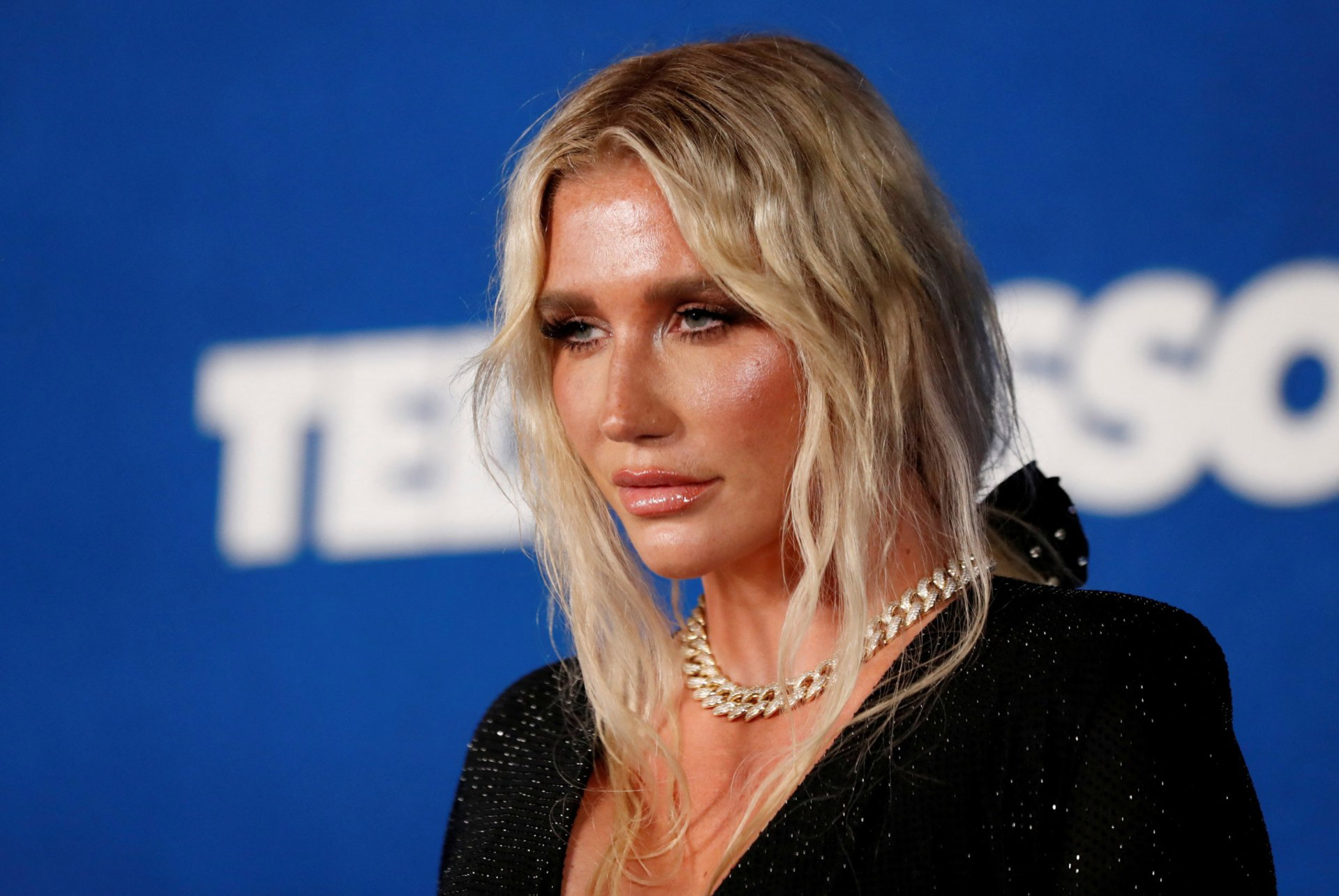 Kesha Urges ‘sugar Daddies To Message Her After Being Dumped For First Time Ever
