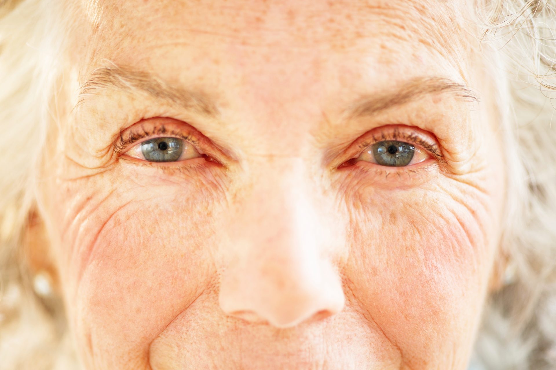 заболевания глаз в пожилом возрасте картинки