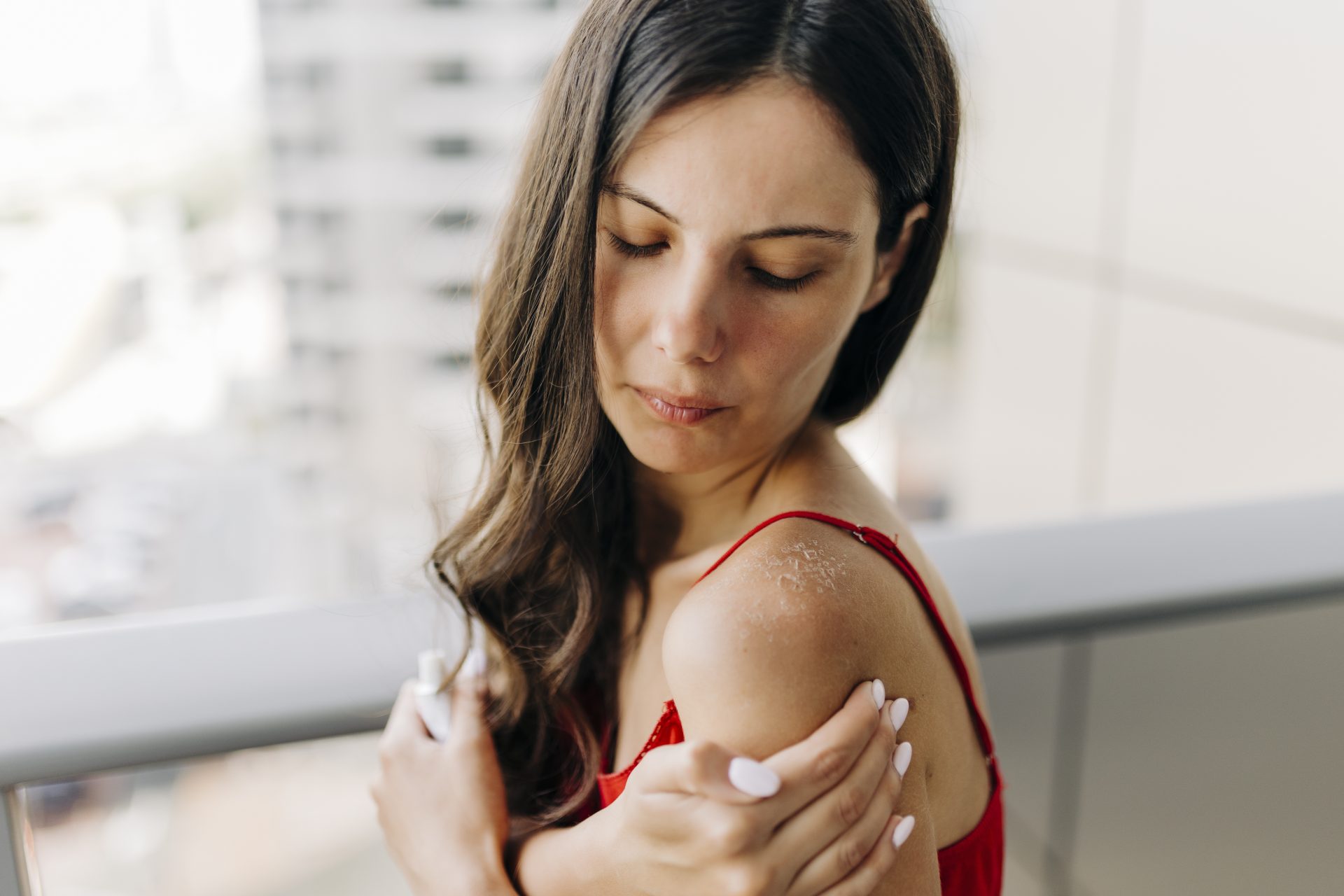 Did you get burned? Here's what you should and shouldn't do